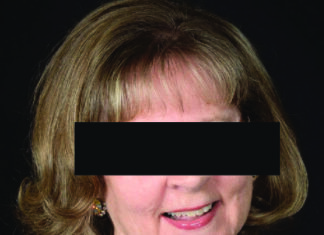 PLU budget cuts lead to staff and faculty members’ distrust towards administration